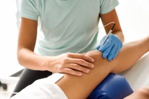 Skleroterapia w Warszawie